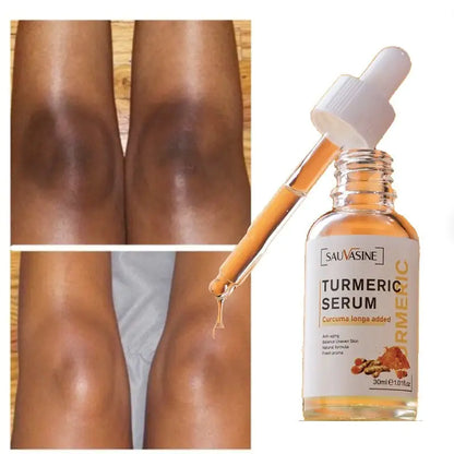 Natural Glow Serum: Turmeric Infused Skincare Solution - Charm Trove