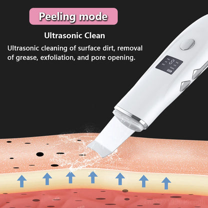 Ultrasonic Peeling Remover Blackhead Facial Skin Scrubber Facial Shovel Deep Cleaning Face Lifting Removal Pore Acne EMS Lift