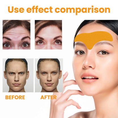 Forehead Wrinkle Removal Patch Beauty Tools Forehead Anti-wrinkle Stickers Anti-aging Fade Smooth for Face Skin Care Accessories