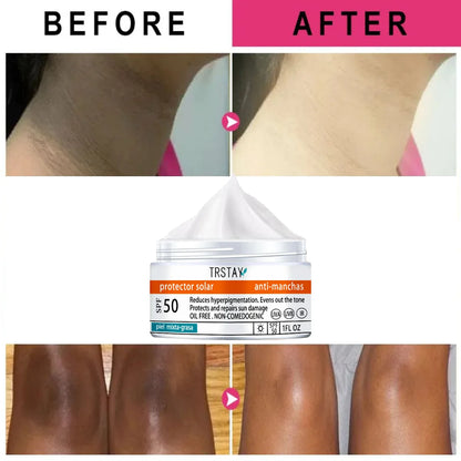 Anti Spot Cream Removes Dullness, Brightens Skin Tone, Moothes Dryness, and Makes Skin Delicate and Smooth