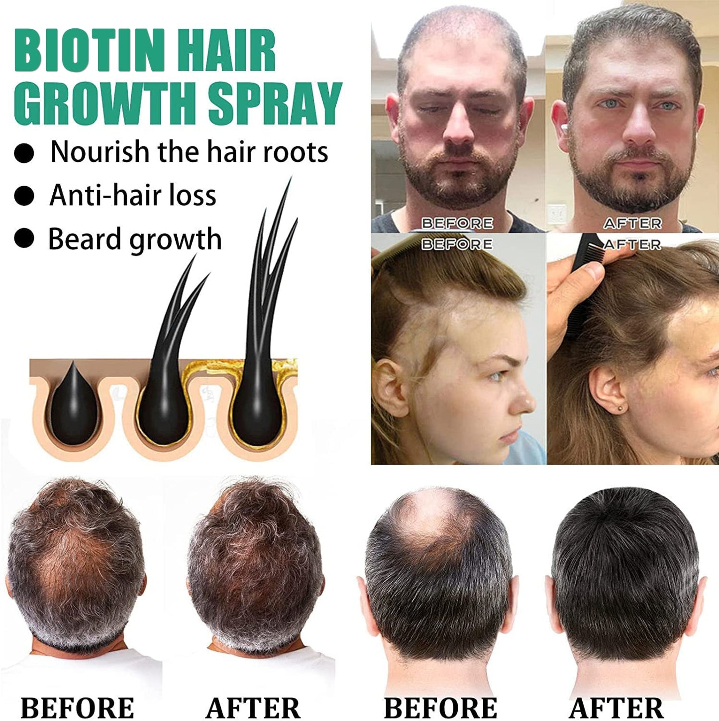 iBeaLee Hair Growth Products Biotin Anti Hair Loss Spray - Charm Trove