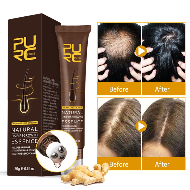 Promote Healthy Hair Growth with PURC 8PCS Hair Growth Products - Charm Trove