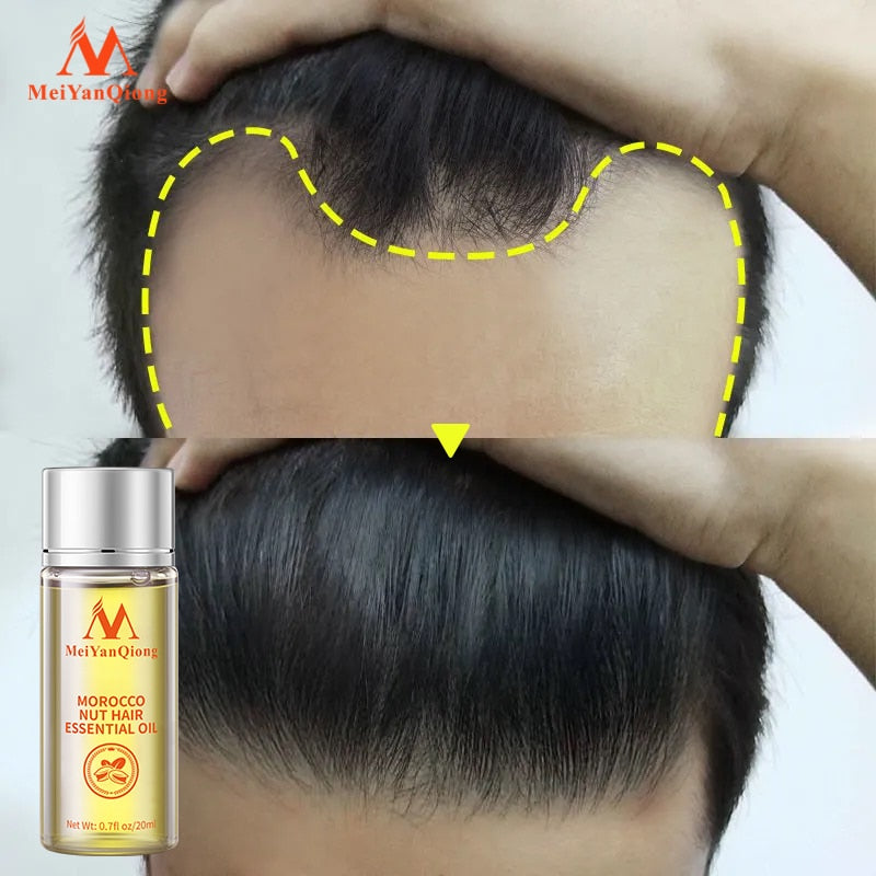 Fast Powerful Hair Growth Essence Hair Oil Liquid Treatment - Charm Trove