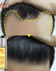 Fast Powerful Hair Growth Essence Hair Oil Liquid Treatment