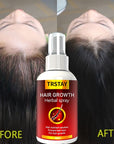 Serum Spray Fast Hair Growth Liquid Treatment