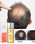 Fast Powerful Hair Growth Essence Hair Oil Liquid Treatment