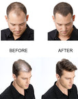 PURC Hair Growth Oil Fast Hair Growth Products Scalp Treatments Prevent Hair Loss Thinning Beauty Hair Care for Men Women 20ml