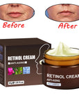 Retinol Moisturizing Cream Fade Wrinkle Firming Lifting Anti-Aging Whitening Cream Brightening Facial Skin Care Cream Cosmetics