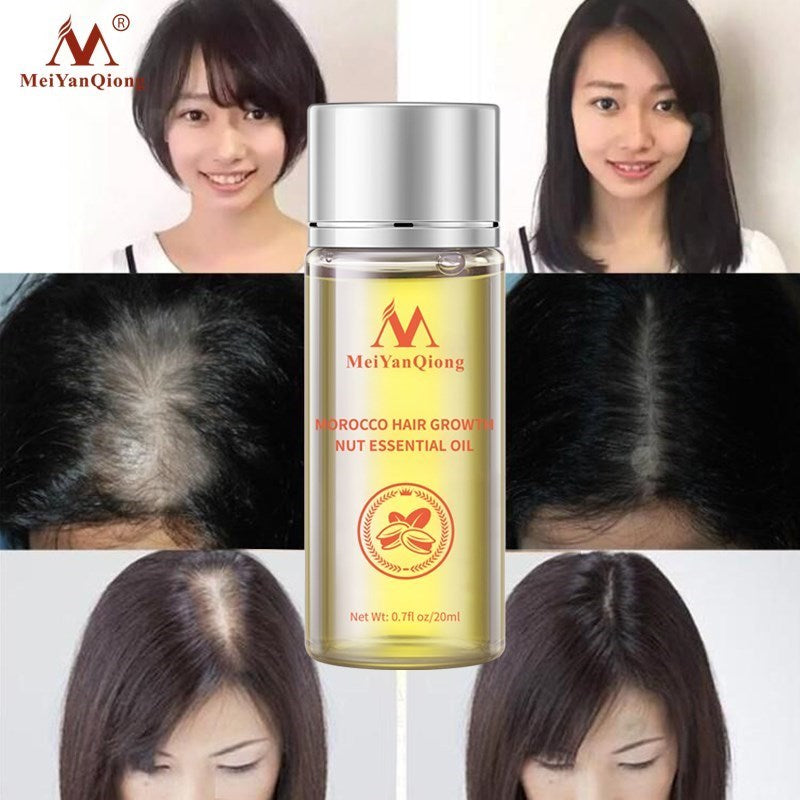 Fast Powerful Hair Growth Essence Hair Oil Liquid Treatment - Charm Trove