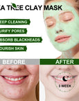 Achieve Clear and Smooth Skin with Acne Removal Face Cream