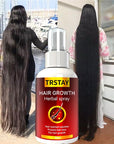 Serum Spray Fast Hair Growth Liquid Treatment