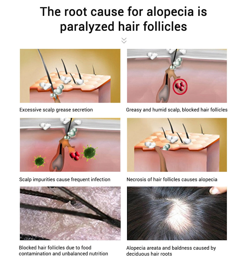 PURC Hair Growth Oil (20ml) - Scalp Nourishment, Hair Strengthening